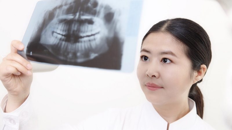 全瓷牙：使用寿命的秘密与护理要点